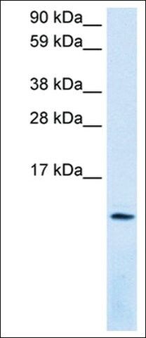 Anti-CXCL12 antibody produced in rabbit