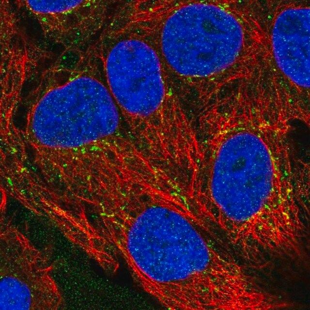 Anti-CXCL16 antibody produced in rabbit