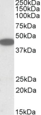 Anti-CXCR6 (C-terminal) antibody produced in goat