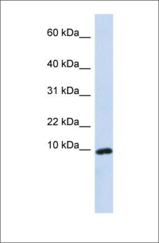 Anti-CXCL9 antibody produced in rabbit