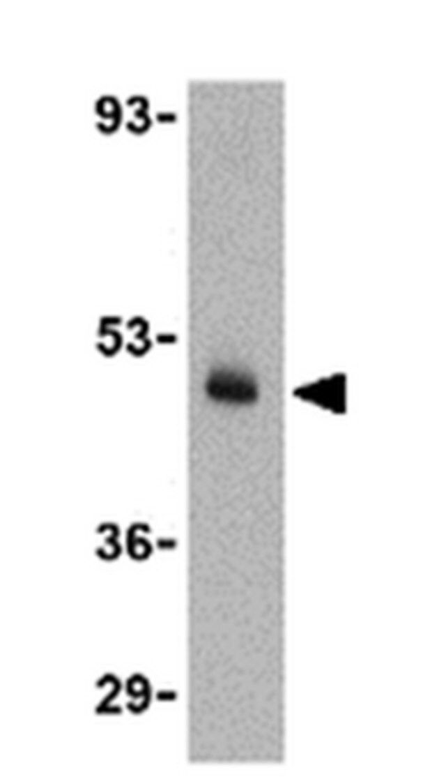 Anti-CX3CL1 Antibody