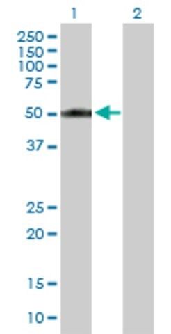 Anti-CYP2A13 antibody produced in mouse