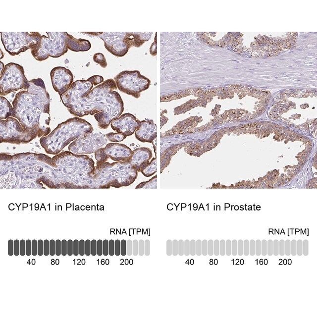 Anti-CYP19A1 antibody produced in rabbit