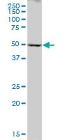 Anti-CYP2A6 antibody produced in mouse