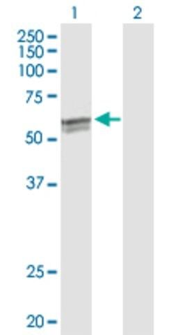 Anti-CYP27A1 antibody produced in rabbit