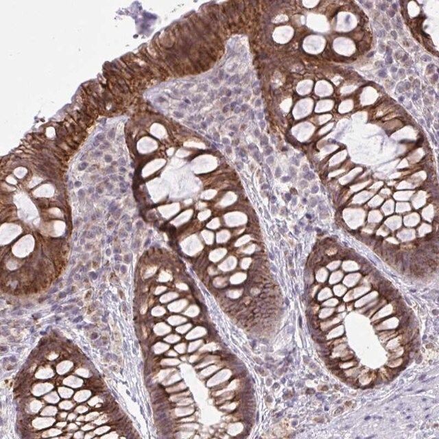 Anti-CYP20A1 antibody produced in rabbit