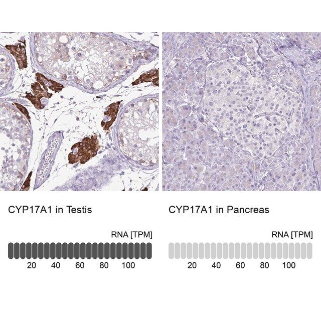 Anti-CYP17A1 antibody produced in rabbit