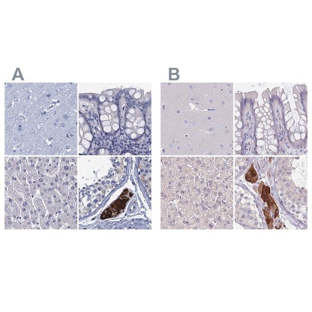 Anti-CYP51A1 antibody produced in rabbit