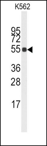 Anti-CYP4A11 (N-term) antibody produced in rabbit