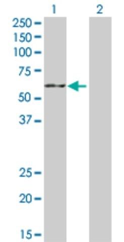 Anti-CYP19A1 antibody produced in rabbit