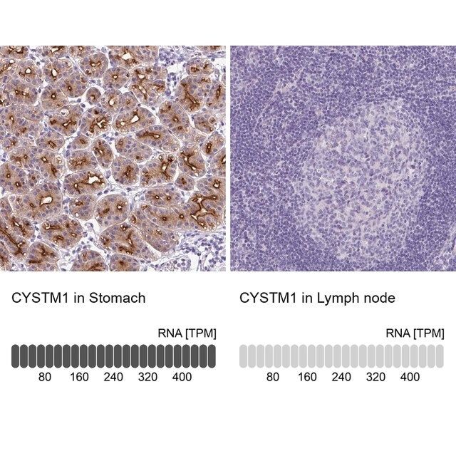 Anti-CYSTM1 antibody produced in rabbit