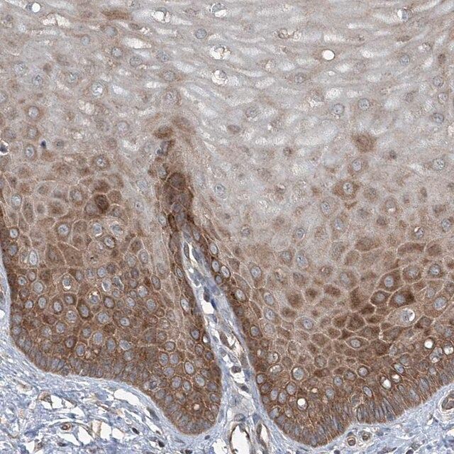 Anti-CYR61 antibody produced in rabbit