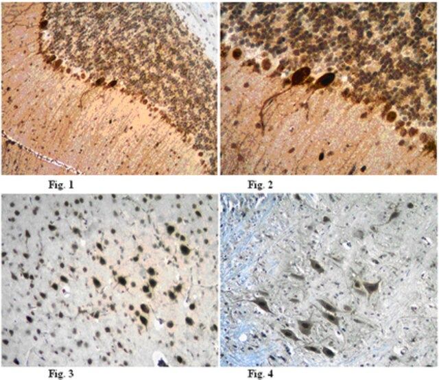 Anti-Cystatin-C Antibody