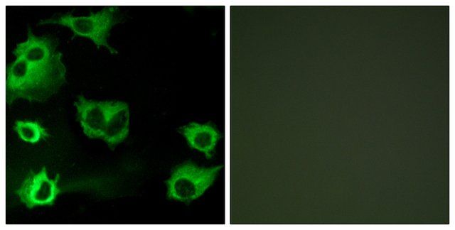 Anti-CYSLTR1 antibody produced in rabbit