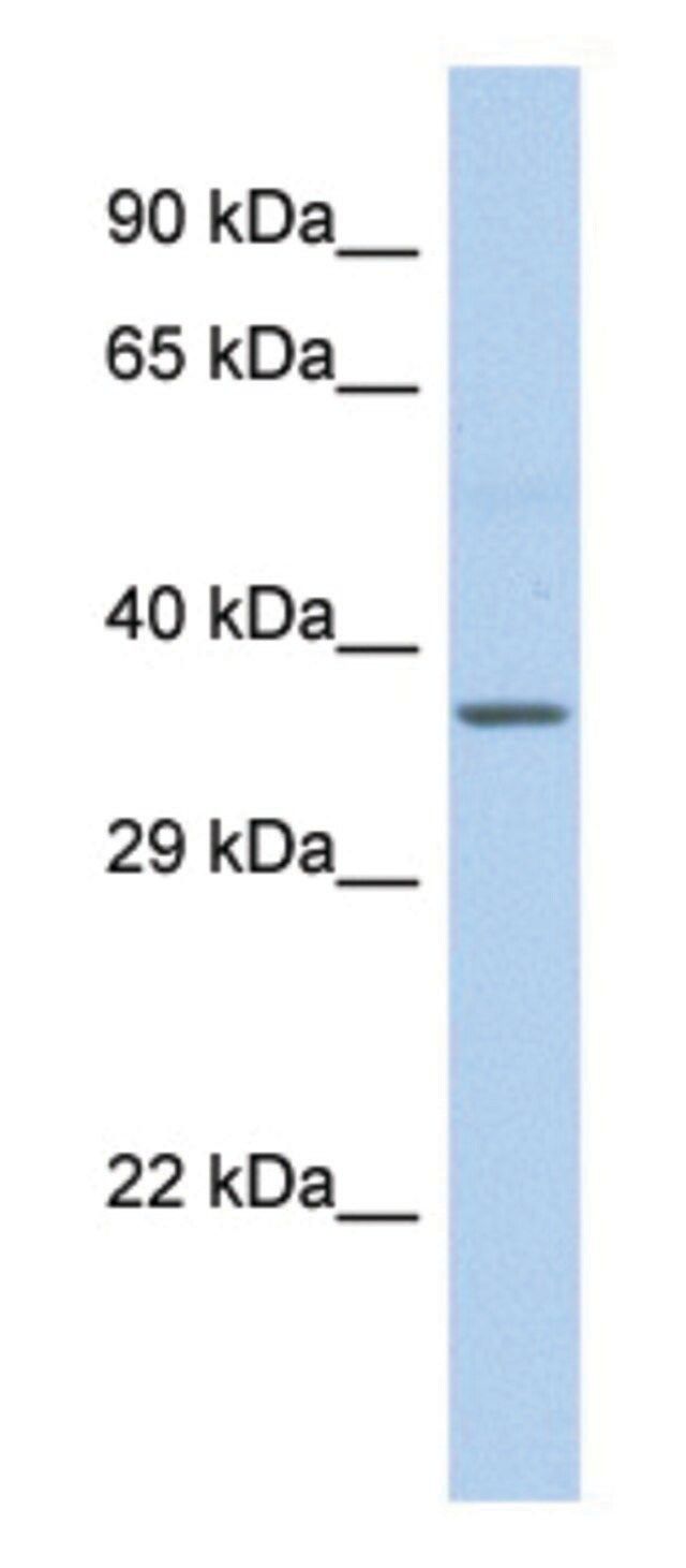 Anti-CYTB (C-terminal) antibody produced in rabbit