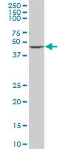 Anti-CYP2D6 antibody produced in mouse