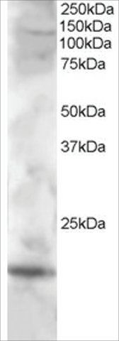 Anti-Cystatin F/CMAP antibody produced in goat