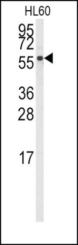 Anti-CYP4Z1 (N-term) antibody produced in rabbit