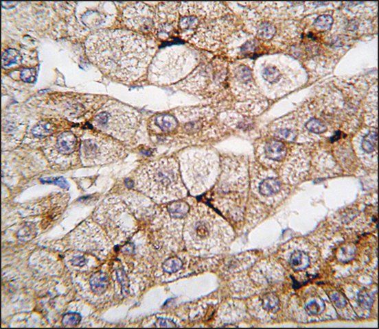 Anti-CYP4F12 (N-term) antibody produced in rabbit