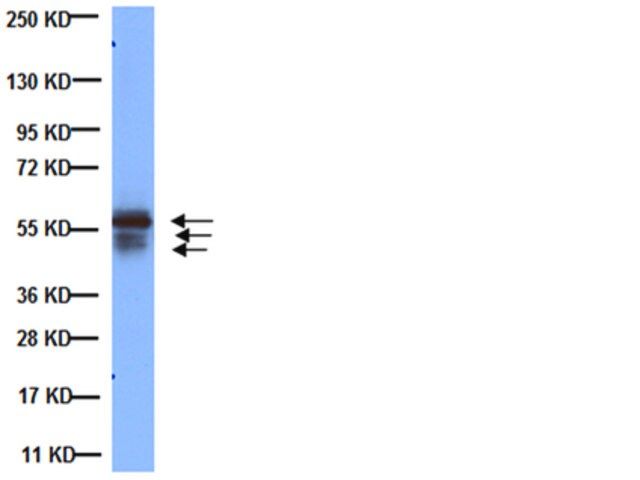 Anti-Cytokeratin AE1/AE3 Antibody, recognizes acidic &basic cytokeratins, clone AE1/AE3