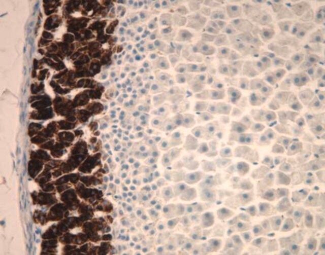 Anti-Cytochrome P450 Aldosterone Synthase Antibody, clone 1G5