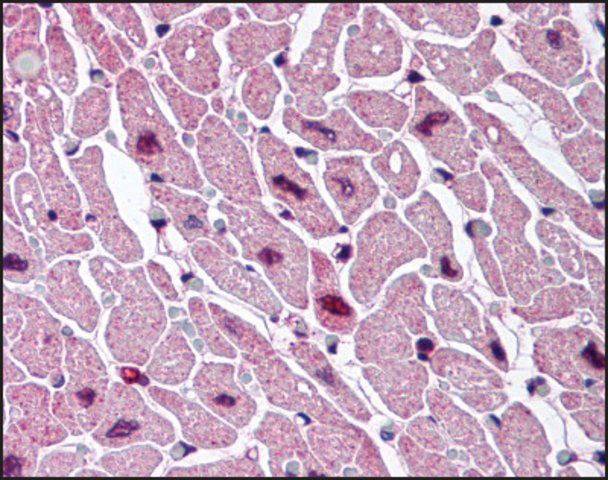 Anti-CYSLT2 (AB2) antibody produced in rabbit