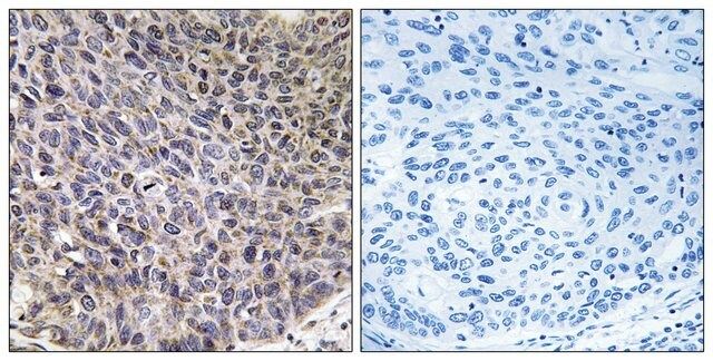 Anti-Cytochrome P450 4B1 antibody produced in rabbit