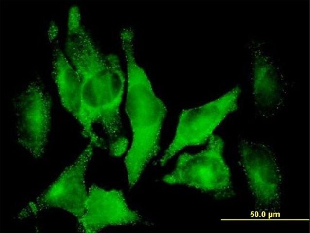 Anti-DAB2 antibody produced in mouse