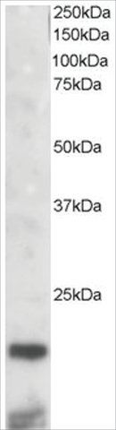 Anti-Cystatin 3 antibody produced in goat