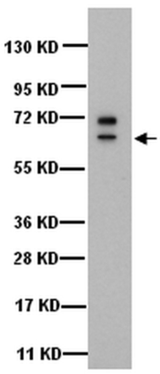 Anti-Cytokeratin 5 Antibody, 6, clone D5/16B4