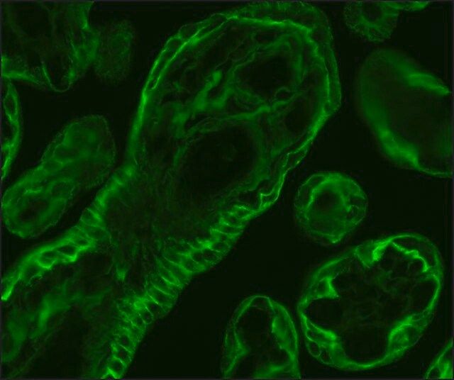 Anti-Cytokeratin Peptide 18 antibody, Mouse monoclonal