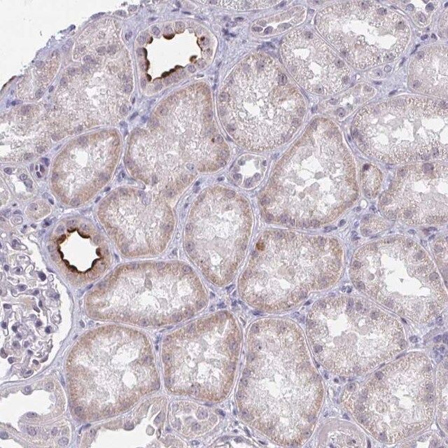 Anti-DAOA antibody produced in rabbit