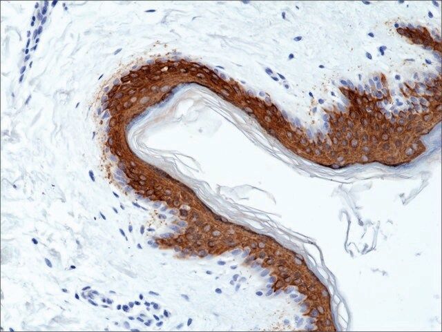 Anti-Cytokeratin 10 (CK-10) antibody, Rabbit monoclonal