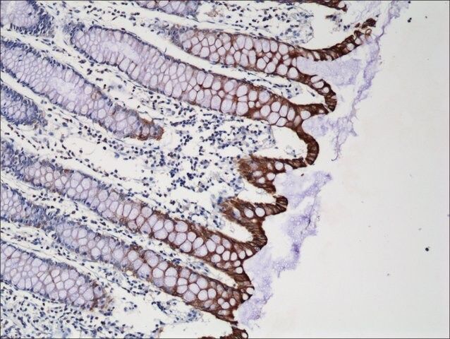 Anti-Cytokeratin-20 antibody, Rabbit Monoclonal