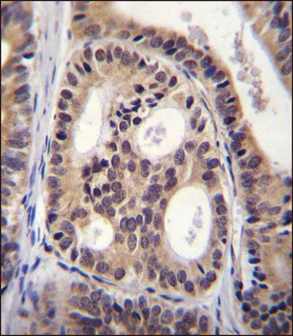 ANTI-CYTSA (N-TERM) antibody produced in rabbit