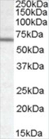 Anti-Dachshund Homolog 2/DACH2 antibody produced in goat