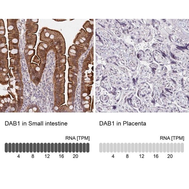 Anti-DAB1 antibody produced in rabbit