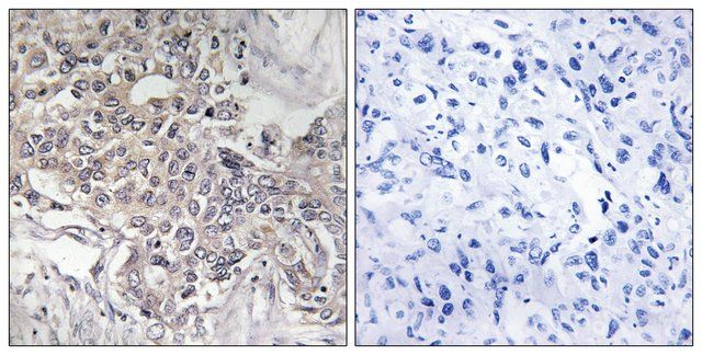 Anti-Cytochrome P450 4Z1 antibody produced in rabbit