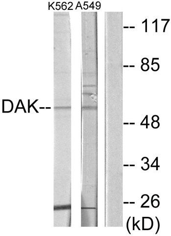 Anti-DAK antibody produced in rabbit