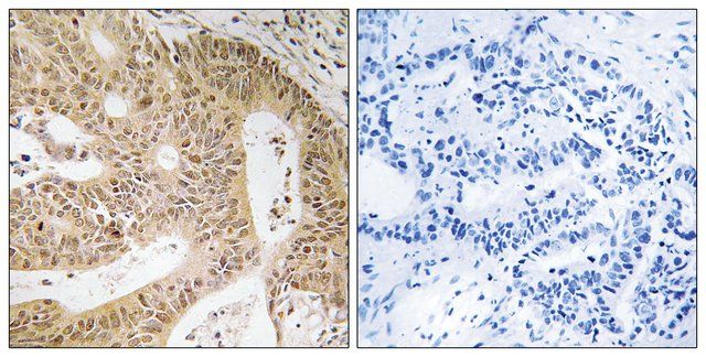 Anti-DAP antibody produced in rabbit