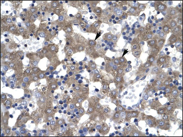 Anti-DACH2 antibody produced in rabbit