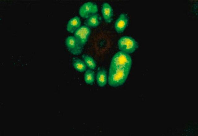 Anti-Cytomegalovirus Antibody, early, clone 5A8.2