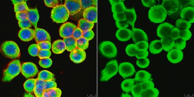 Anti-Cytokeratin 8/18 Antibody, clone L2A1