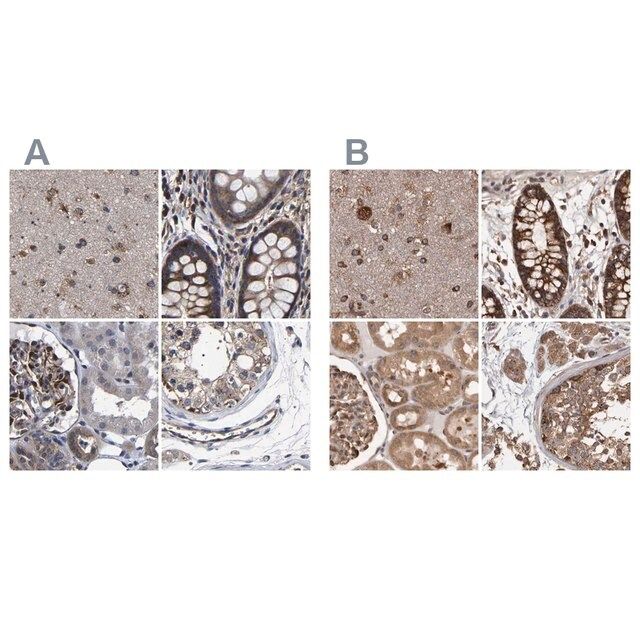 Anti-DARS antibody produced in rabbit