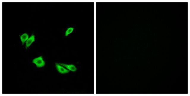 Anti-DAB1 antibody produced in rabbit