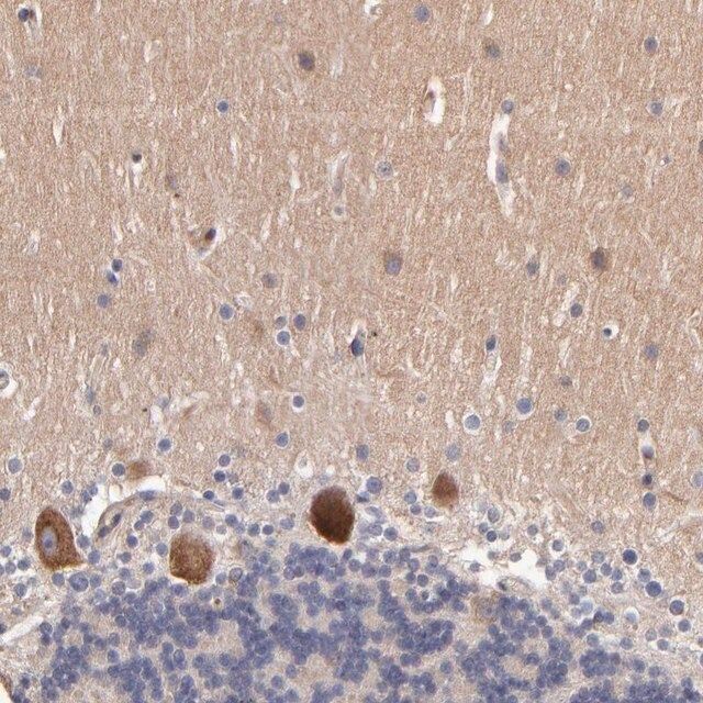 Anti-DACT1 antibody produced in rabbit