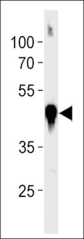 ANTI-DANRE ACTBA (CENTER) antibody produced in rabbit