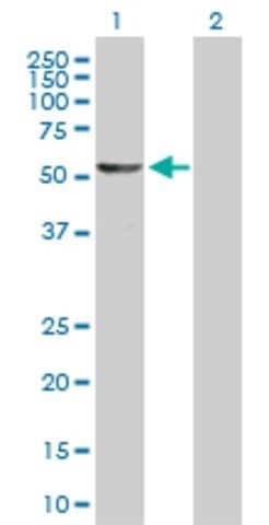 Anti-DALRD3 antibody produced in mouse