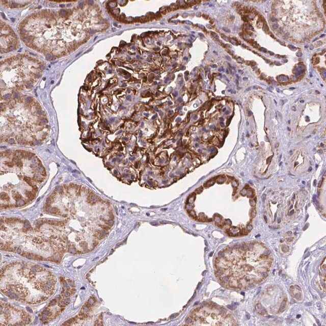 Anti-CYYR1 antibody produced in rabbit