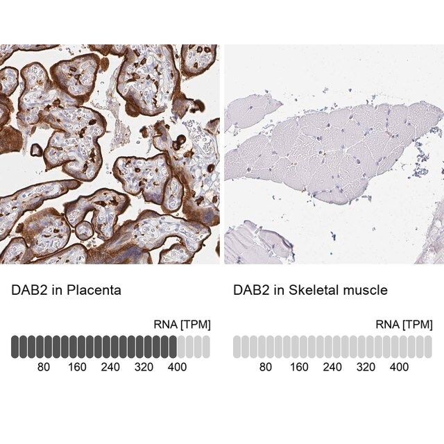 Anti-DAB2 antibody produced in rabbit